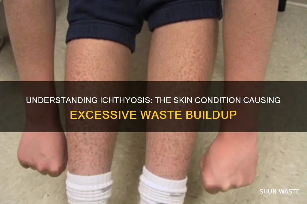 what is that skin waste disease called