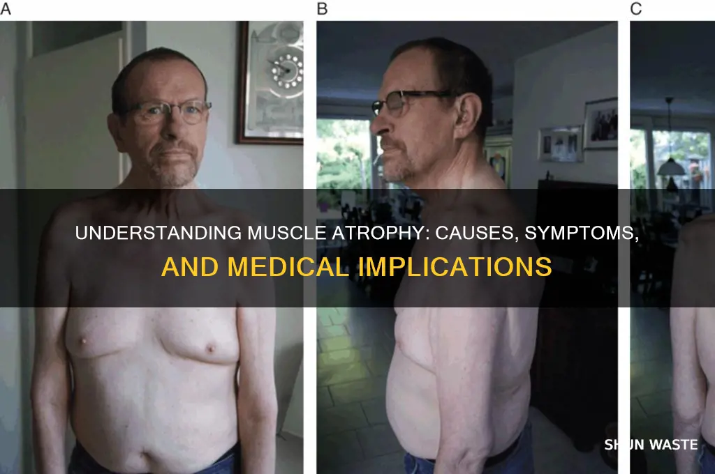 what is waste of muscle in medical terms
