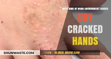 Harsh Work Conditions Leading to Dry, Cracked Hands: Causes and Solutions