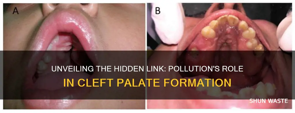 what pollution causes cleft pallet