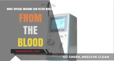Revolutionary Hemodialysis Machine: Filtering Waste from Blood Efficiently