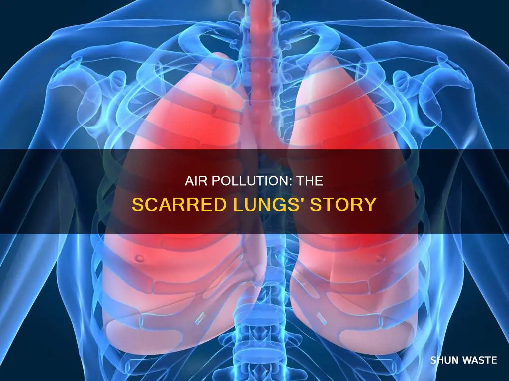 which air pollutant scars the lungs