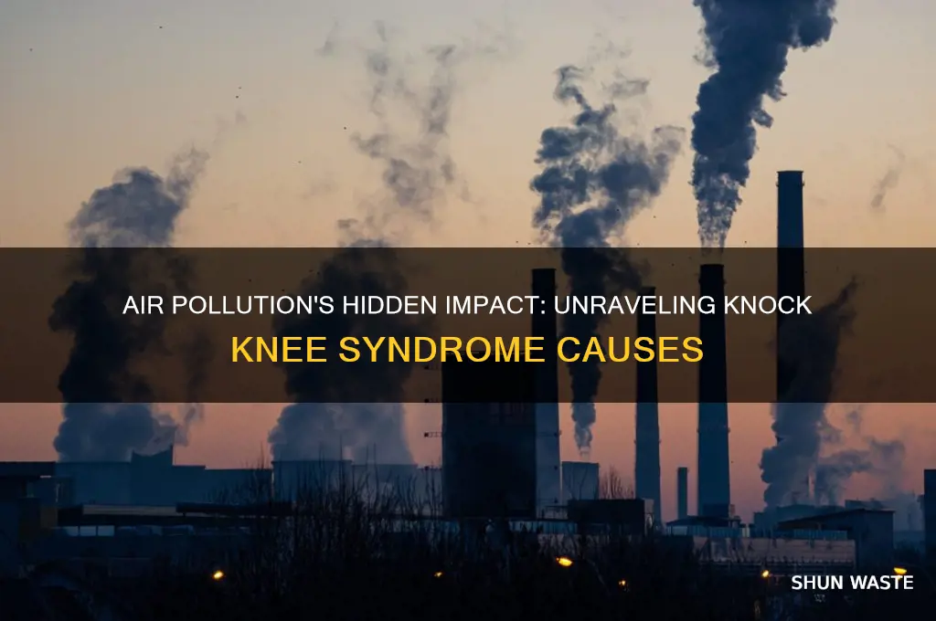 which pollution is responsible for knock knee syndrome